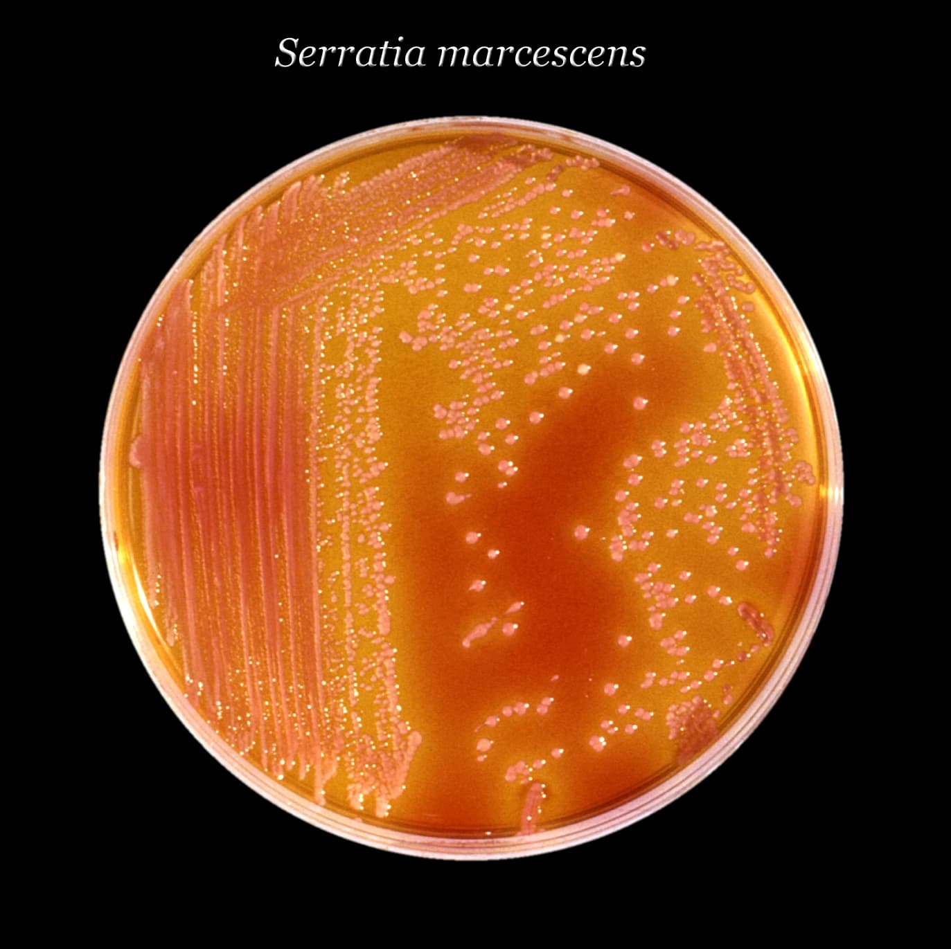 Rote Kolonien des Bakteriums Serratia marcescens auf einer Agarplatte, CDC-Fotografie