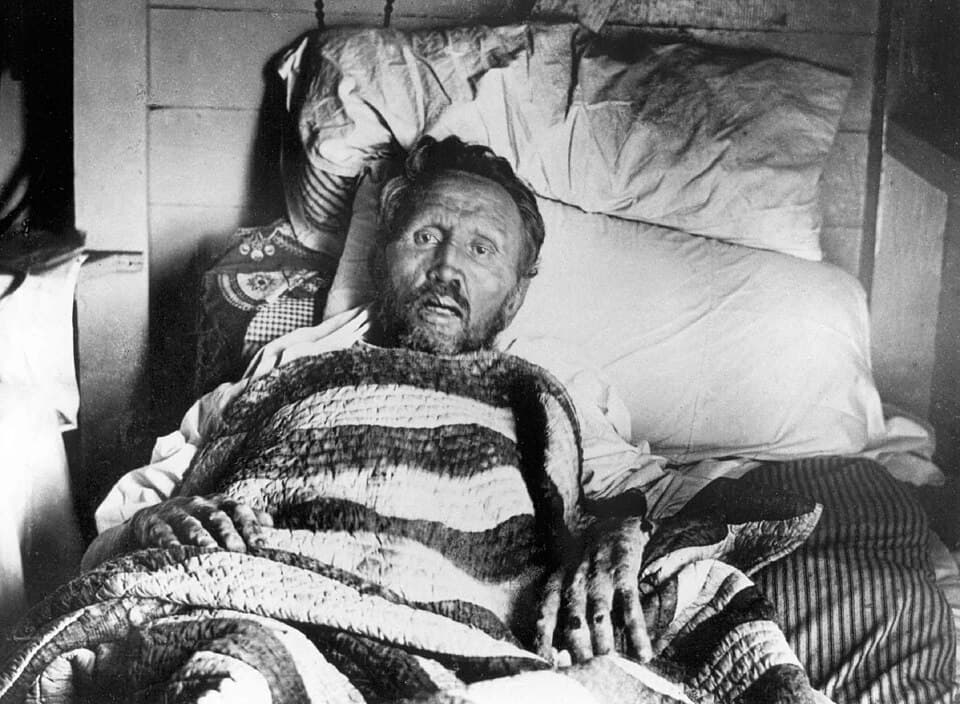 Damian von Molokai auf seinem Sterbebett 1889